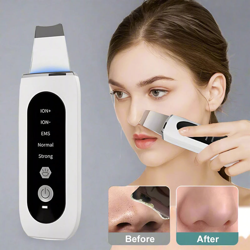 Ultrasonic Face Skin Scrubber